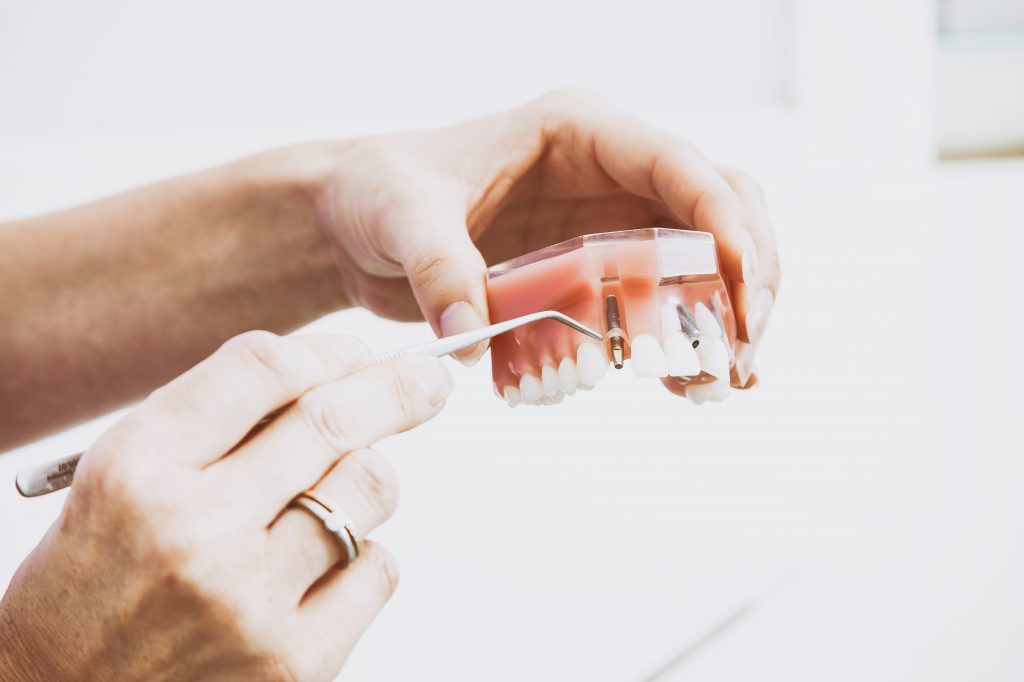 Are Dental Implants Right For You?