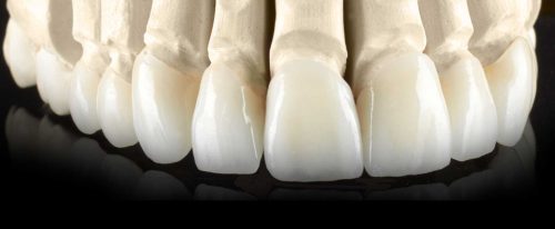 cosmetic dentistry treatment