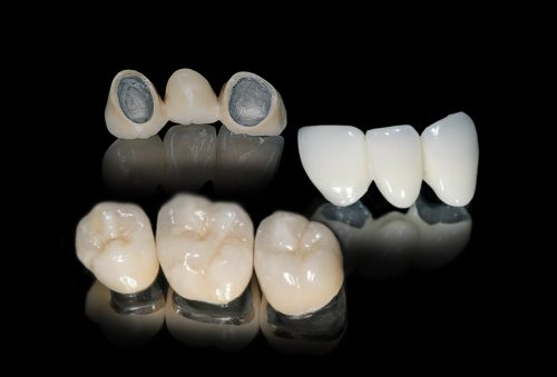 cosmetic dentistry treatment